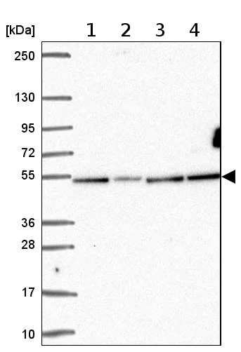 Western blot - Anti-ZNF692 antibody (AB204595)