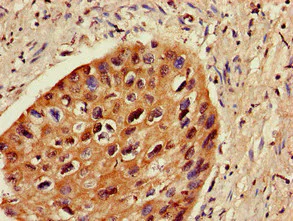 Immunohistochemistry (Formalin/PFA-fixed paraffin-embedded sections) - Anti-ZNF695 antibody (AB237811)