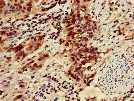 Immunohistochemistry (Formalin/PFA-fixed paraffin-embedded sections) - Anti-ZNF695 antibody (AB237811)