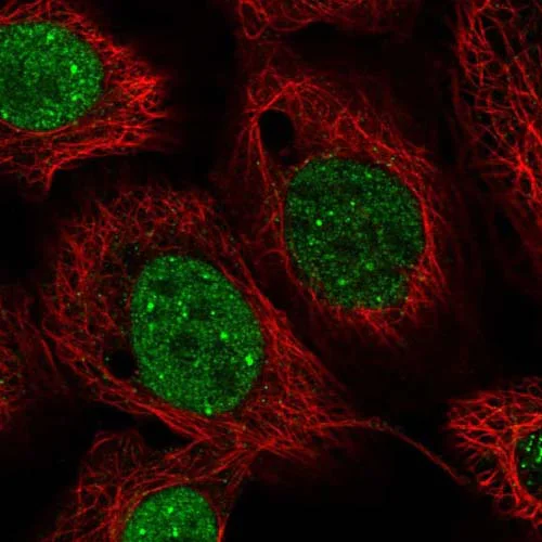 Immunocytochemistry/ Immunofluorescence - Anti-ZNF704 antibody (AB121804)