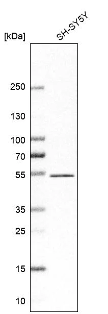 Western blot - Anti-ZNF704 antibody (AB121804)