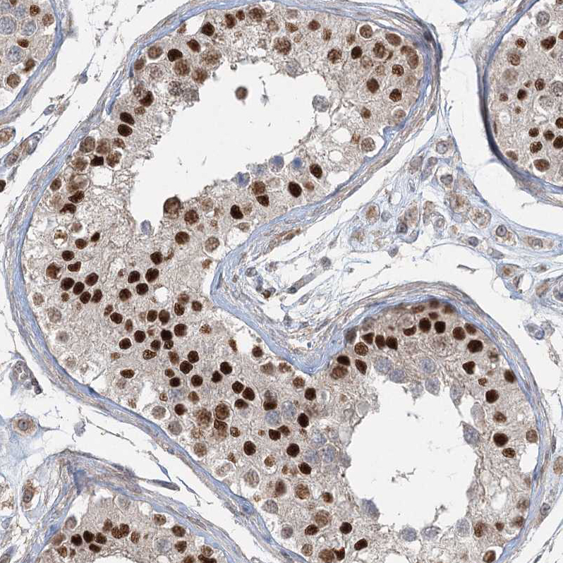 Immunohistochemistry (Formalin/PFA-fixed paraffin-embedded sections) - Anti-ZNF711 antibody (AB254776), expandable thumbnail