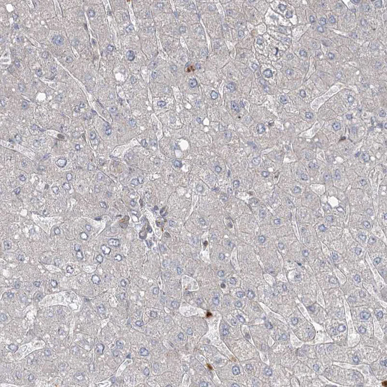 Immunohistochemistry (Formalin/PFA-fixed paraffin-embedded sections) - Anti-ZNF711 antibody (AB254776)