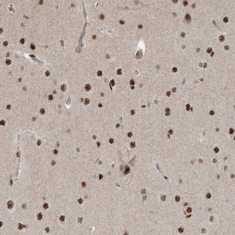 Immunohistochemistry (Formalin/PFA-fixed paraffin-embedded sections) - Anti-ZNF711 antibody (AB254776), expandable thumbnail
