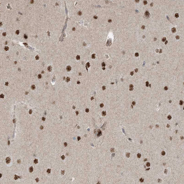 Immunohistochemistry (Formalin/PFA-fixed paraffin-embedded sections) - Anti-ZNF711 antibody (AB254776)