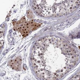 Immunohistochemistry (Formalin/PFA-fixed paraffin-embedded sections) - Anti-ZNF717 antibody (AB126486)