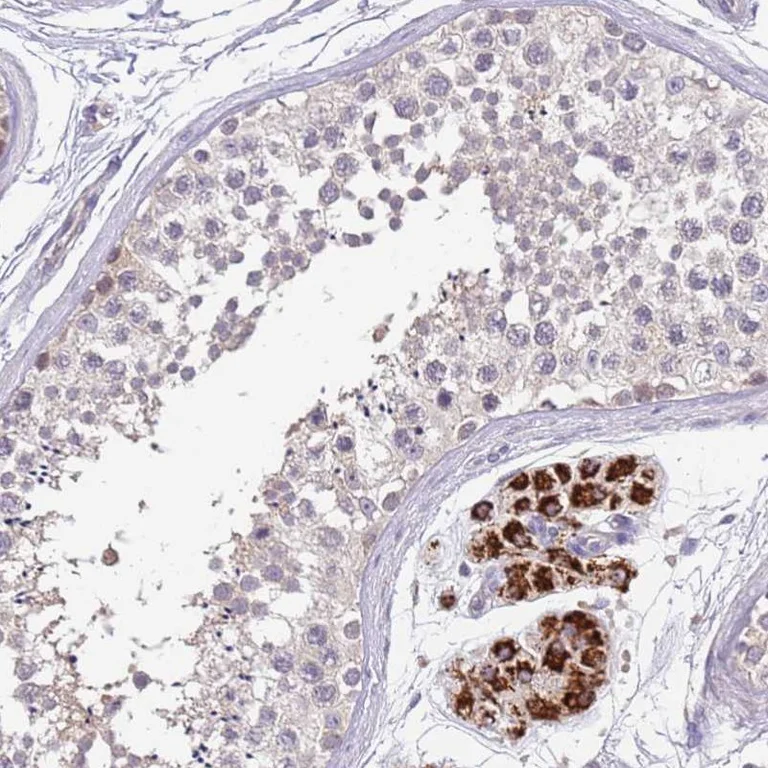 Immunohistochemistry (Formalin/PFA-fixed paraffin-embedded sections) - Anti-ZNF746 Antibody (AB327201)