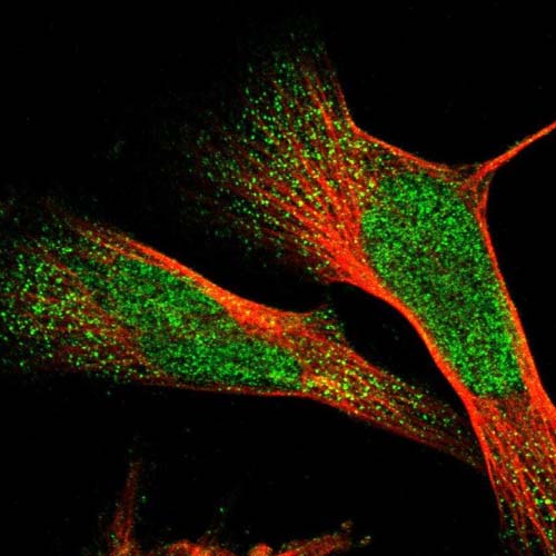 Immunocytochemistry/ Immunofluorescence - Anti-ZNF750 antibody (AB121685)
