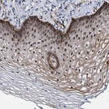 Immunohistochemistry (Formalin/PFA-fixed paraffin-embedded sections) - Anti-ZNF750 antibody (AB121685)