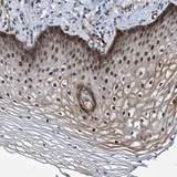 Immunohistochemistry (Formalin/PFA-fixed paraffin-embedded sections) - Anti-ZNF750 antibody (AB121685)