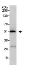 Immunoprecipitation - Anti-ZNF787 antibody (AB117837)