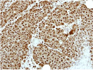 Immunohistochemistry (Formalin/PFA-fixed paraffin-embedded sections) - Anti-ZNF83 antibody - N-terminal (AB154640)