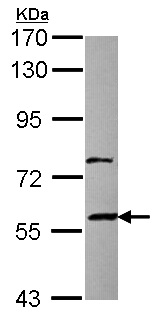 Western blot - Anti-ZNF83 antibody - N-terminal (AB154640)