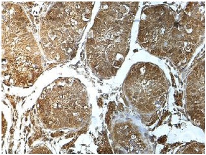 Immunohistochemistry (Formalin/PFA-fixed paraffin-embedded sections) - Anti-ZNF85 antibody (AB197299), expandable thumbnail