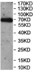 Western blot - Anti-ZNF85 antibody (AB197299), expandable thumbnail