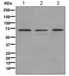 Western blot - Anti-ZNF92 antibody [EPR11514] (AB170885)