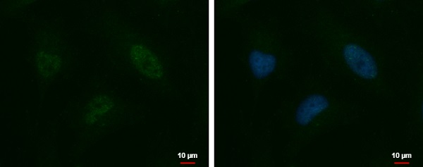 Immunocytochemistry/ Immunofluorescence - Anti-ZNFN1A2/HELIOS antibody (AB227429), expandable thumbnail