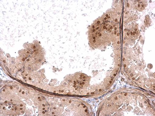 Immunohistochemistry (Formalin/PFA-fixed paraffin-embedded sections) - Anti-ZNFN1A2/HELIOS antibody (AB227429), expandable thumbnail
