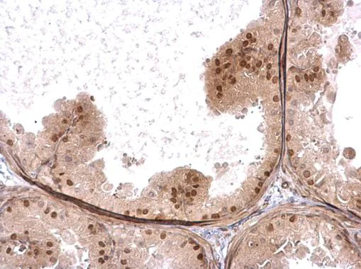 Immunohistochemistry (Formalin/PFA-fixed paraffin-embedded sections) - Anti-ZNFN1A2/HELIOS antibody (AB227429)