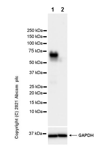 Western blot - Anti-ZNFN1A2/HELIOS antibody [EPR23200-40] (AB252411), expandable thumbnail