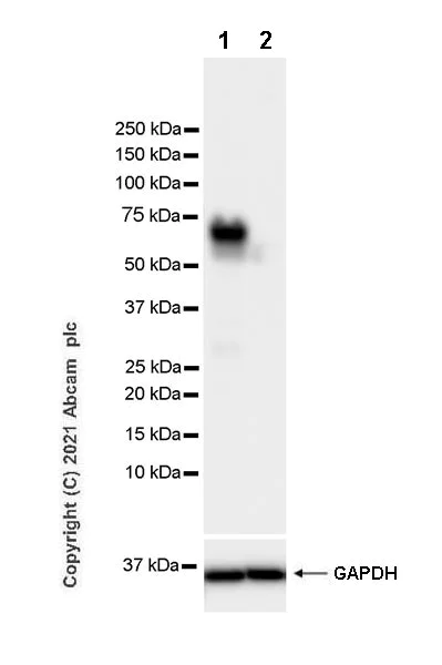 Western blot - Anti-ZNFN1A2/HELIOS antibody [EPR23200-40] (AB252411)