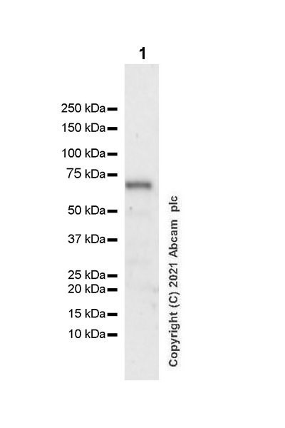 Western blot - Anti-ZNFN1A2/HELIOS antibody [EPR23200-40] (AB252411), expandable thumbnail