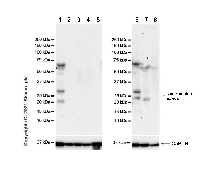 Western blot - Anti-ZNFN1A2/HELIOS antibody [EPR23200-40] (AB252411)