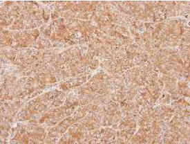 Immunohistochemistry (Formalin/PFA-fixed paraffin-embedded sections) - Anti-ZNHIT1 antibody (AB151248)