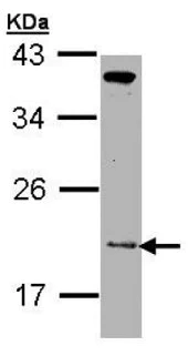Western blot - Anti-ZNHIT1 antibody (AB151248)