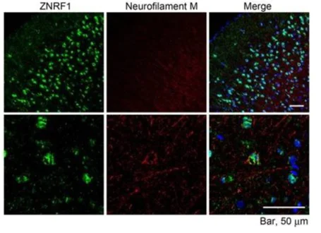 Immunohistochemistry (Formalin/PFA-fixed paraffin-embedded sections) - Anti-ZNRF1 antibody (AB175125)