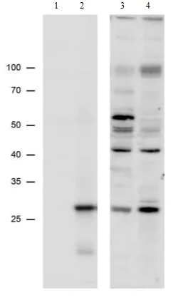 Western blot - Anti-ZNRF1 antibody (AB175125)