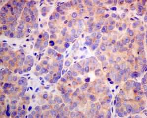 Immunohistochemistry (Formalin/PFA-fixed paraffin-embedded sections) - Anti-ZNRF2 antibody [EPR11399(B)] (AB156011)