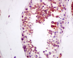 Immunohistochemistry (Formalin/PFA-fixed paraffin-embedded sections) - Anti-ZNRF2 antibody [EPR11399(B)] (AB156011)