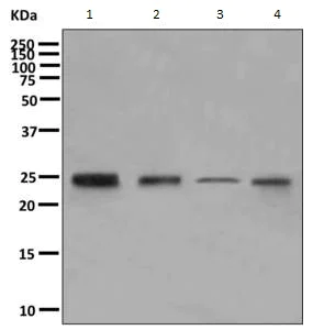 Western blot - Anti-ZNRF2 antibody [EPR11399(B)] (AB156011)