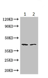 Western blot - Anti-ZnT-7 antibody (AB223065)