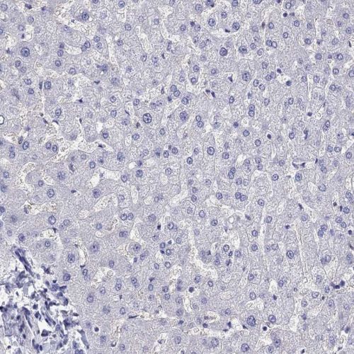 Immunohistochemistry (Formalin/PFA-fixed paraffin-embedded sections) - Anti-ZnT-8 antibody (AB244550), expandable thumbnail