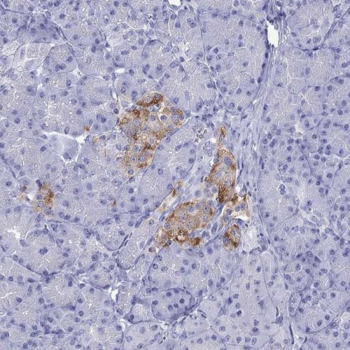 Immunohistochemistry (Formalin/PFA-fixed paraffin-embedded sections) - Anti-ZnT-8 antibody (AB244550), expandable thumbnail