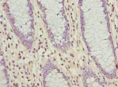 Immunohistochemistry (Formalin/PFA-fixed paraffin-embedded sections) - Anti-Znt6 antibody (AB237492)