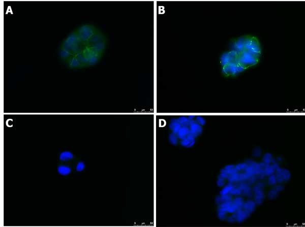 ZO-1 tight junction protein antibody - rabbit polyclonal