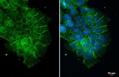 Immunocytochemistry/ Immunofluorescence - Anti-ZO1 tight junction protein antibody (AB96587)
