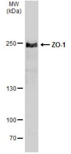 Western blot - Anti-ZO1 tight junction protein antibody (AB96587), expandable thumbnail