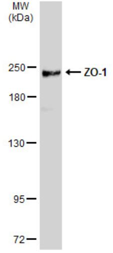Western blot - Anti-ZO1 tight junction protein antibody (ab96587), expandable thumbnail