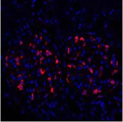 Immunohistochemistry (Formalin/PFA-fixed paraffin-embedded sections) - Anti-ZO1 tight junction protein antibody [BLR092G] (AB276131)