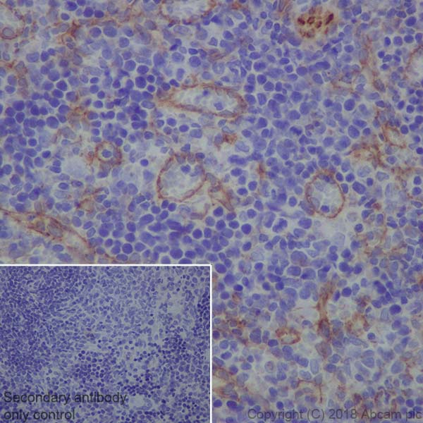 Immunohistochemistry (Formalin/PFA-fixed paraffin-embedded sections) - Anti-ZO1 tight junction protein antibody [EPR19945-224] - BSA and Azide free (AB251567), expandable thumbnail