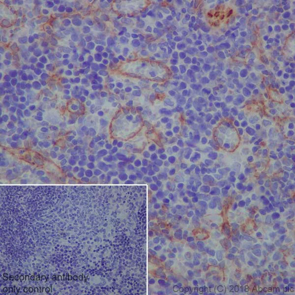Immunohistochemistry (Formalin/PFA-fixed paraffin-embedded sections) - Anti-ZO1 tight junction protein antibody [EPR19945-224] - BSA and Azide free (AB251567)