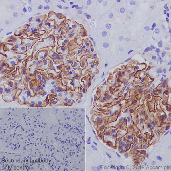 Immunohistochemistry (Formalin/PFA-fixed paraffin-embedded sections) - Anti-ZO1 tight junction protein antibody [EPR19945-224] - BSA and Azide free (AB251567), expandable thumbnail