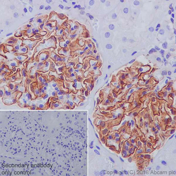 Immunohistochemistry (Formalin/PFA-fixed paraffin-embedded sections) - Anti-ZO1 tight junction protein antibody [EPR19945-224] - BSA and Azide free (AB251567)