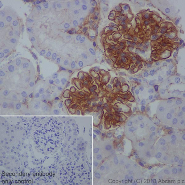 Immunohistochemistry (Formalin/PFA-fixed paraffin-embedded sections) - Anti-ZO1 tight junction protein antibody [EPR19945-224] - BSA and Azide free (AB251567), expandable thumbnail
