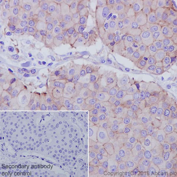Immunohistochemistry (Formalin/PFA-fixed paraffin-embedded sections) - Anti-ZO1 tight junction protein antibody [EPR19945-224] - BSA and Azide free (AB251567), expandable thumbnail