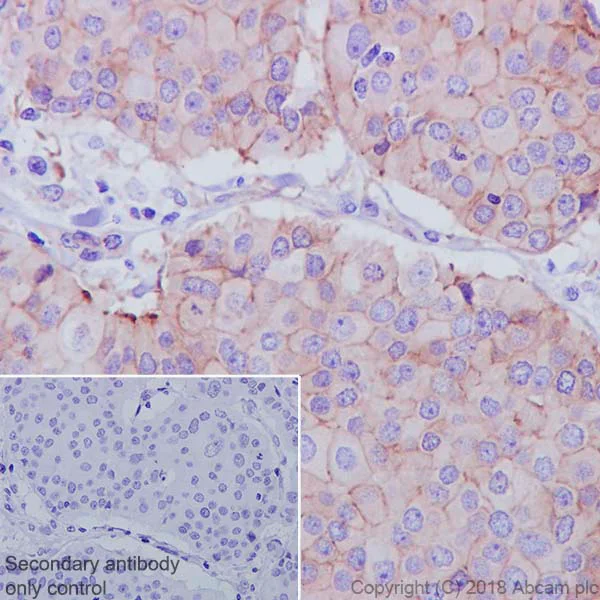 Immunohistochemistry (Formalin/PFA-fixed paraffin-embedded sections) - Anti-ZO1 tight junction protein antibody [EPR19945-224] - BSA and Azide free (AB251567)